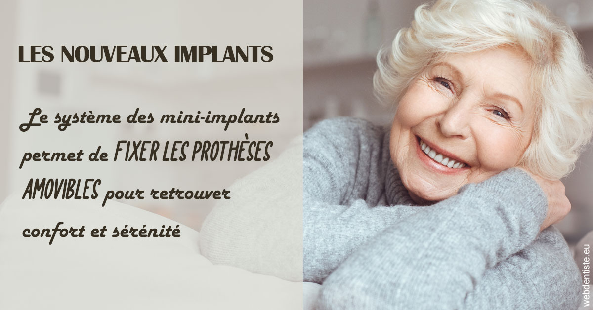 https://dr-bellaiche-jean-marc.chirurgiens-dentistes.fr/Les nouveaux implants 1