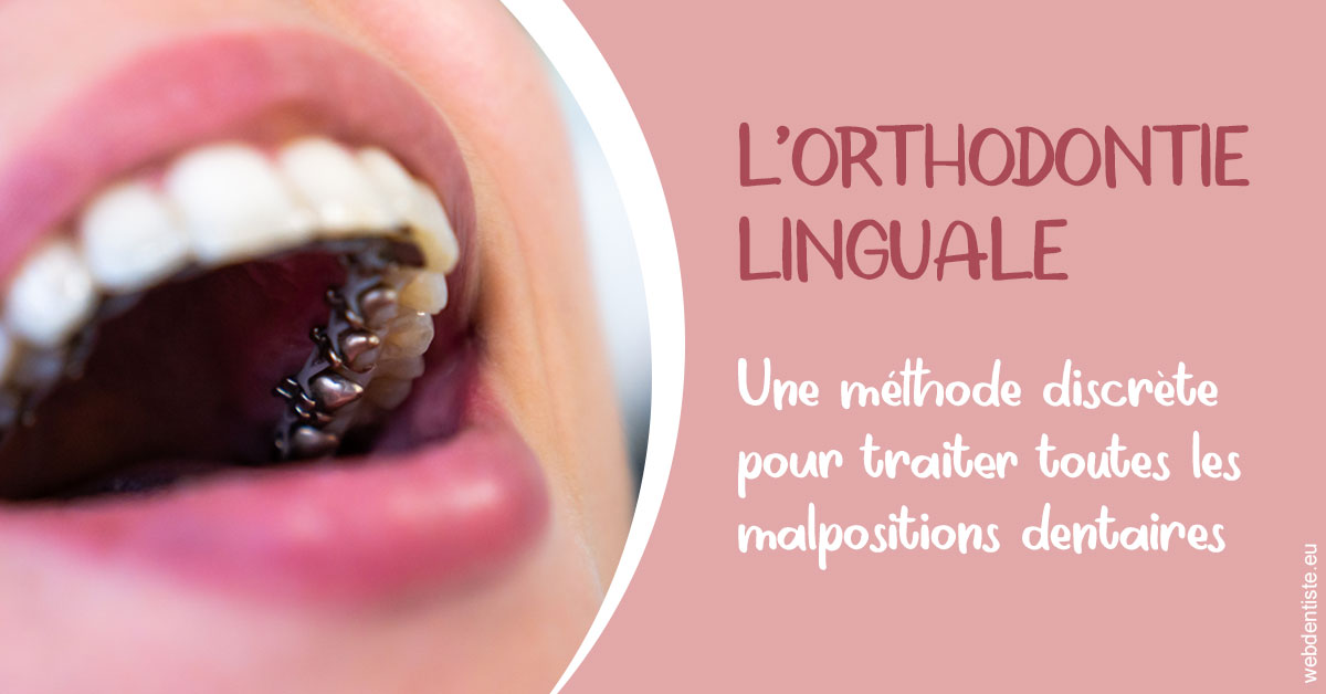 https://dr-bellaiche-jean-marc.chirurgiens-dentistes.fr/L'orthodontie linguale 2