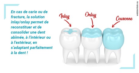 https://dr-bellaiche-jean-marc.chirurgiens-dentistes.fr/L'INLAY ou l'ONLAY