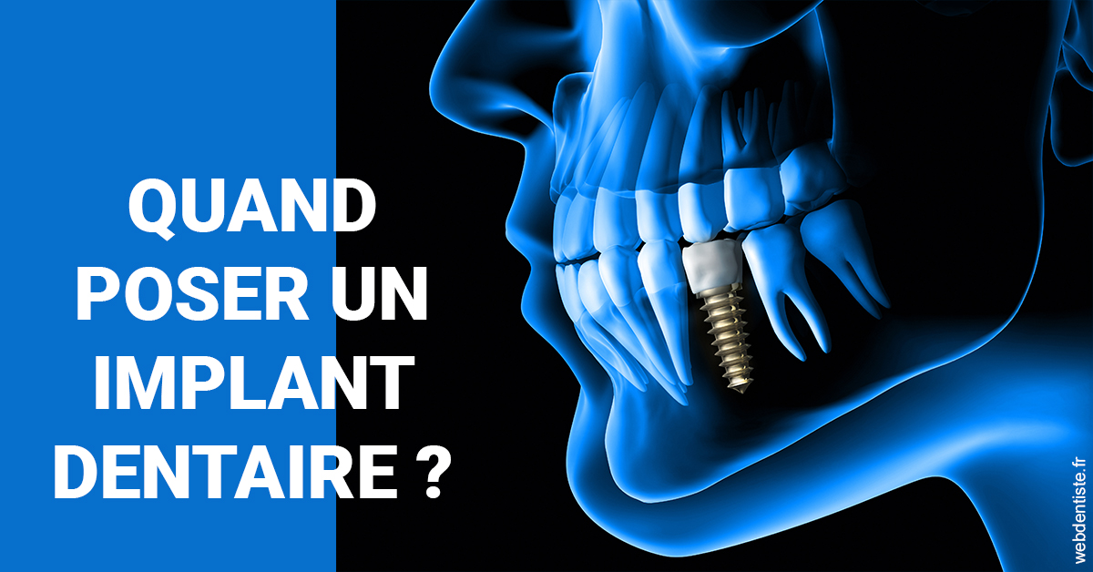 https://dr-bellaiche-jean-marc.chirurgiens-dentistes.fr/Les implants 1