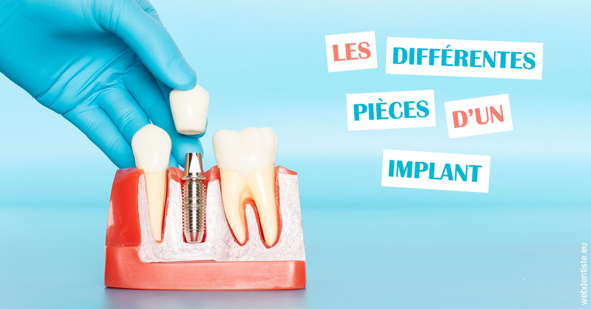 https://dr-bellaiche-jean-marc.chirurgiens-dentistes.fr/Les différentes pièces d’un implant 2