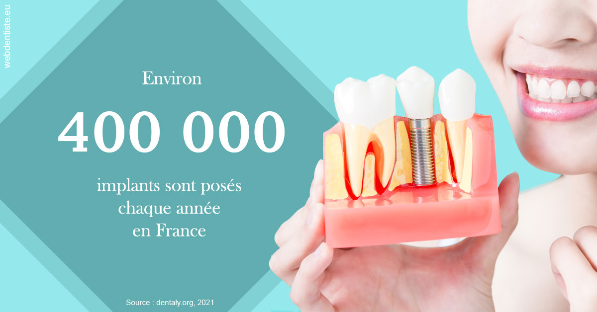 https://dr-bellaiche-jean-marc.chirurgiens-dentistes.fr/Pose d'implants en France 2