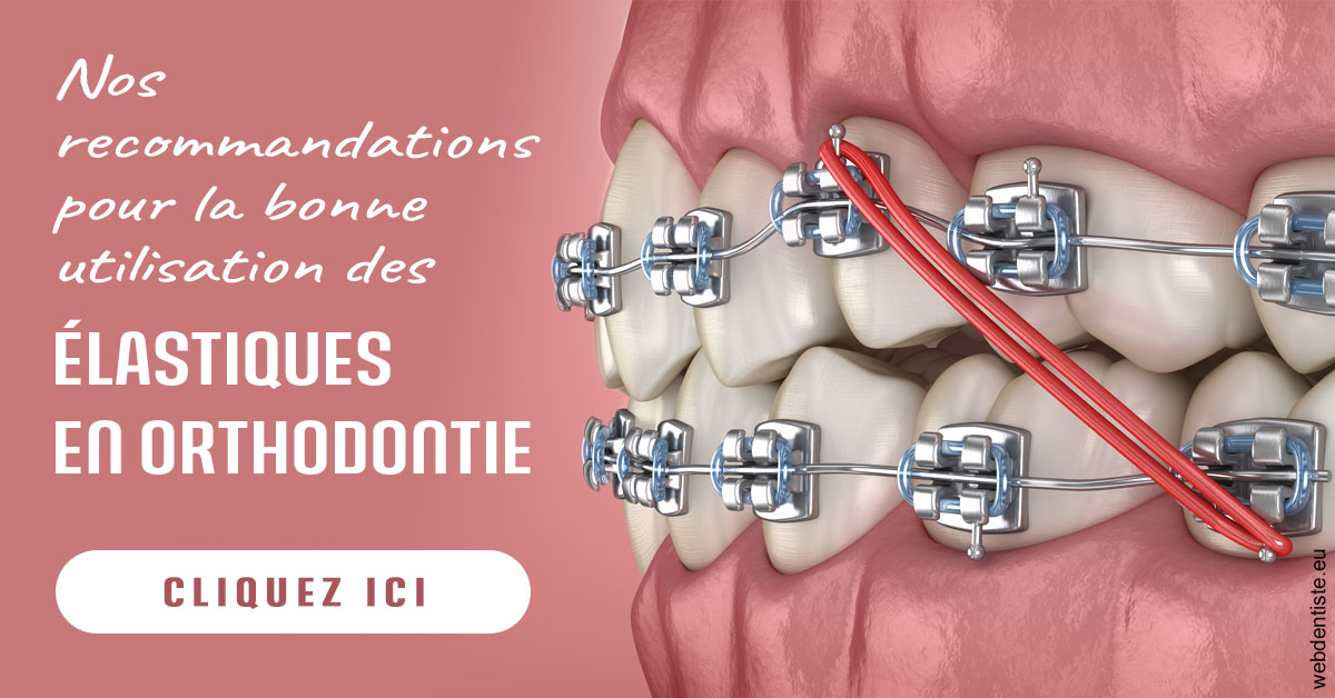 https://dr-bellaiche-jean-marc.chirurgiens-dentistes.fr/Elastiques orthodontie 2